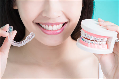 Invisalign2