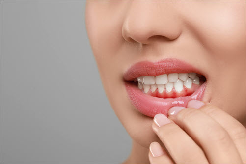 Gum Disease