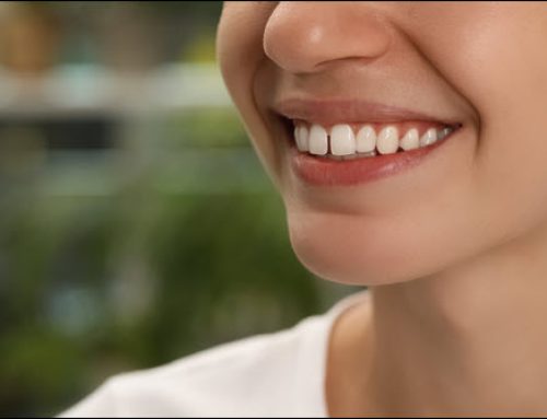 Untreated Overbite: Beyond Cosmetic Concerns